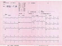 Electrocardiography Wikipedia