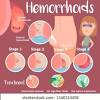 For severe or persistent hemorrhoids, the best thing to do is to see your doctor for treatment; Https Encrypted Tbn0 Gstatic Com Images Q Tbn And9gcrd1rcxl7z F9pbhoh2namifeftwfqgjrewhxyqtif4pyyzo5p Usqp Cau