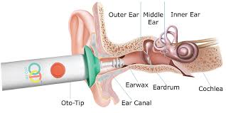 How to clean ears, however, is where things get interesting. Home Oto Tip