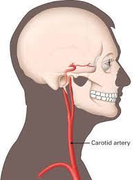 The carotid artery is the major blood vessel that runs up the neck and to the brain. Carotid Arteries American Academy Of Ophthalmology