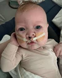 photo of their baby with cleft lip