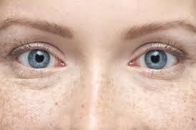 blue eyes prevalence advanes and