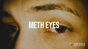 what are meth eyes