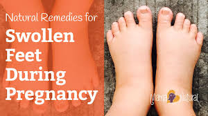 swollen feet during pregnancy natural