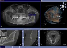 3d imaging white marsh family dentistry