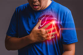 Enfarte do miocárdio, vulgarmente conhecido como um ataque de coração, é uma condição de emergência na qual uma artéria coronária (um vaso o tratamento durante um ataque cardíaco visa alargar o vaso sanguíneo obstruído, remover o bloqueio na artéria do coração e ajudar a pessoa que. Infarto Agudo Do Miocardio Sintomas E Tratamentos Cepic