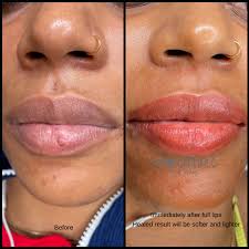 permanent makeup lips results about