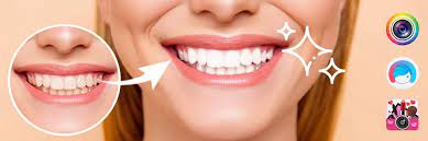 12 best teeth whitening apps to enhance