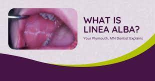 what is linea alba dentist plymouth
