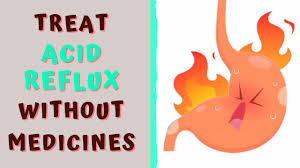 treat acid reflux without cines