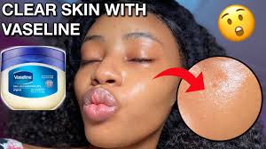 i used vaseline on my face everyday for