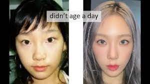 s generation snsd plastic surgery