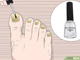 the easiest way to do a nail treatment