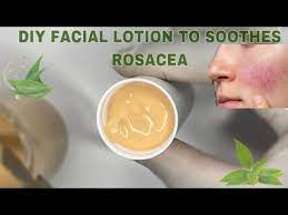 diy face lotion for rosacea sensitive