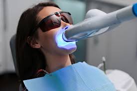 teeth whitening treatment gpa dental
