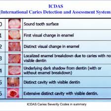 A Completed Icdas Chart Download Scientific Diagram