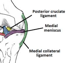 These symptoms can include popping, stiffness, buckling and pain. Medial Collateral Ligament Tear Grading Management Teachmesurgery