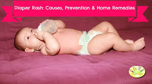home remedy for diaper rash shishuworld