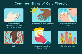 cold fingers meaning when to worry