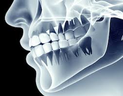 A toothache is a painful annoyance, especially at night. Sinus Pain Or Abscessed Tooth Rotem Dental Care