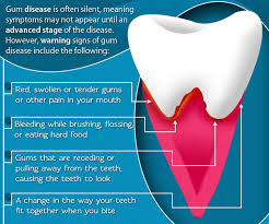 periodontal gum and bone therapy