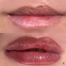 lip blush treatment the ultimate