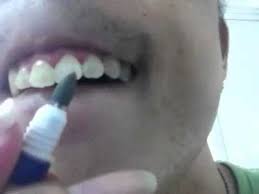 Whitish teeth are the symbol of a beautiful smile. How To Remove Coffee Stains From Your Teeth Inexpensively Youtube