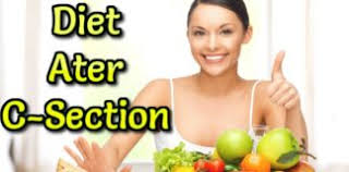Foods You Can Eat After C Section Diet Plan For Cesarean