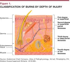 Figure 1 From Treatment Of The Burn Patient In Primary Care