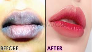 get soft pink lips naturally at home in