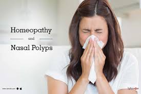 homeopathic cine for nasal polyps