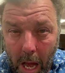 The host of the bbc one television show … Homes Under The Hammer Star Martin Roberts Issues Warning To Gardeners As He S Hospitalised After Touching Poisonous Plant Huffpost Uk