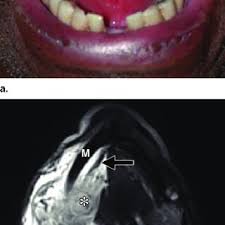 pdf imaging the floor of the mouth