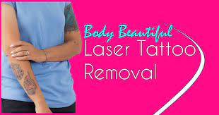 tattoo removal pittsburgh pa body