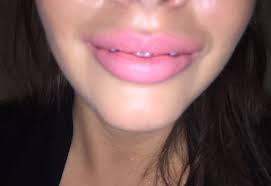 these indentations in my lips are they