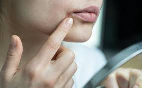 cheilitis lip inflammation causes