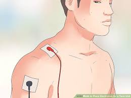 How To Place Electrodes For A Tens Unit A Visual Guide To