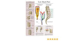 Low Back Pain E Chart Quick Reference Guide