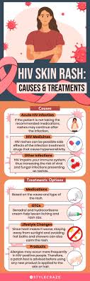 hiv skin rashes symptoms causes and