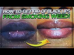 get rid of dark lips from smoking weed
