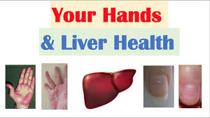 your hands liver health what your