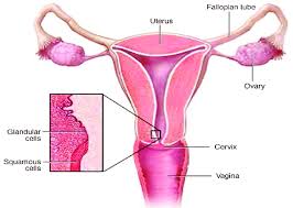 schematic diagram of cervix and uterus