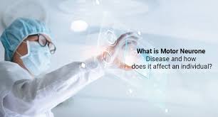 what is motor neurone disease and how