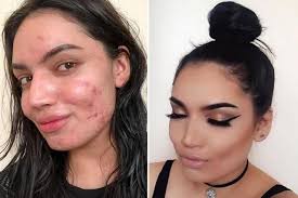 masalah kulit dengan teknik makeup