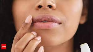 relieve dry lips during pregnancy