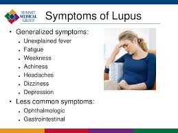 Image result for lupus
