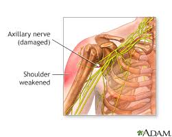 axillary nerve dysfunction information