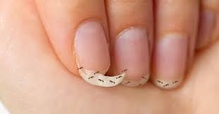 do ants eat fingernails explained