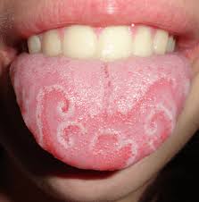 Check Your Tongue Ayurveda Everyday Ayurveda