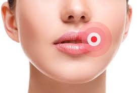 swollen lips symptoms causes